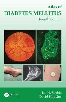Hardcover Atlas of Diabetes Mellitus Book