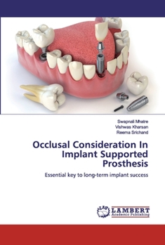 Paperback Occlusal Consideration In Implant Supported Prosthesis Book