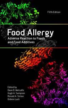 Hardcover Food Allergy: Adverse Reaction to Foods and Food Additives Book