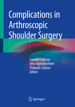 Paperback Complications in Arthroscopic Shoulder Surgery Book