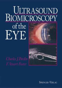 Paperback Ultrasound Biomicroscopy of the Eye Book