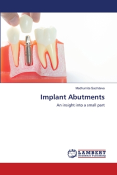 Paperback Implant Abutments Book