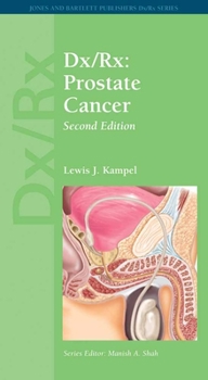Paperback DX/Rx: Prostate Cancer: Prostate Cancer Book