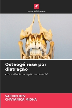 Paperback Osteogénese por distração [Portuguese] Book