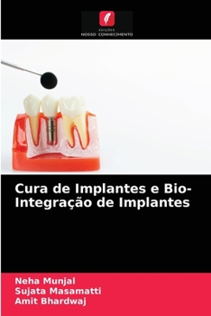 Paperback Cura de Implantes e Bio- Integração de Implantes [Portuguese] Book