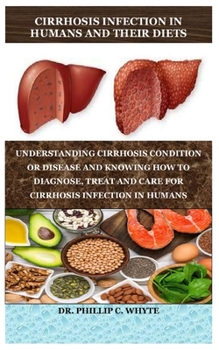 CIRRHOSIS INFECTION IN HUMANS AND THEIR DIETS: UNDERSTANDING CIRRHOSIS CONDITION OR DISEASE AND KNOWING HOW TO DIAGNOSE, TREAT AND CARE FOR CIRRHOSIS INFECTION IN HUMANS