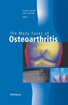 Hardcover The Many Faces of Osteoarthritis Book