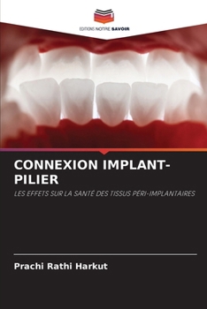 Connexion Implant-Pilier (French Edition)