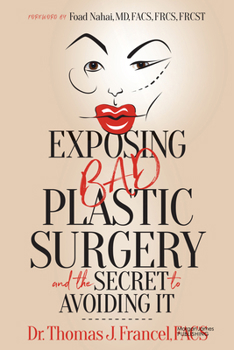 Paperback Exposing Bad Plastic Surgery: And the Secret to Avoiding It Book