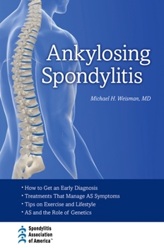 Hardcover Ankylosing Spondylitis C Book