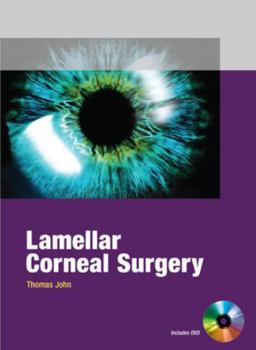 Hardcover Lamellar Corneal Surgery Book