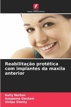 Paperback Reabilitação protética com implantes da maxila anterior [Portuguese] Book