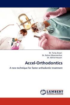 Paperback Accel-Orthodontics Book
