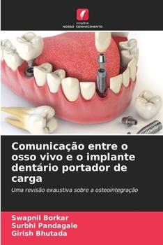 Paperback Comunicação entre o osso vivo e o implante dentário portador de carga [Portuguese] Book
