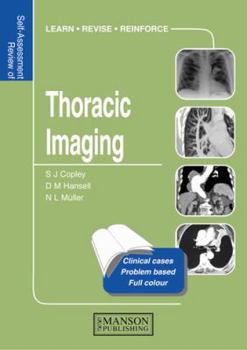 Paperback Thoracic Imaging: Self-Assessment Color Review Book