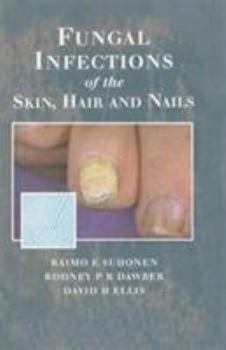 Hardcover Fungal Infections of the Skin and Nails Book