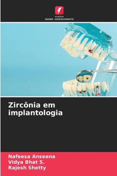 Zircônia em implantologia (Portuguese Edition)
