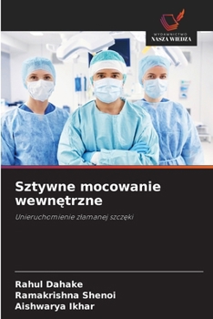 Sztywne mocowanie wewnetrzne: Unieruchomienie zlamanej szczeki (Polish Edition)