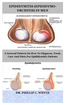 EPIDIDYMITIS (EPIDIDYMO-ORCHITIS) IN MEN: A General Pattern On How To Diagnose, Treat, Care And Diets For Epididymitis Patients