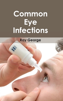 Hardcover Common Eye Infections Book