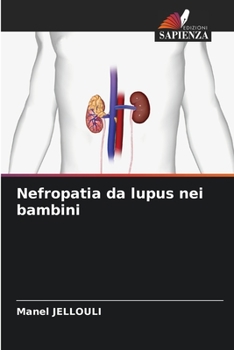 Paperback Nefropatia da lupus nei bambini [Italian] Book