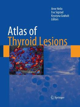 Paperback Atlas of Thyroid Lesions Book