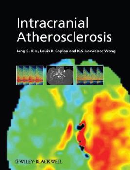 Hardcover Intracranial Atherosclerosis Book