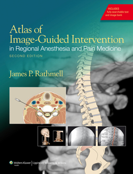 Hardcover Atlas of Image-Guided Intervention in Regional Anesthesia and Pain Medicine Book