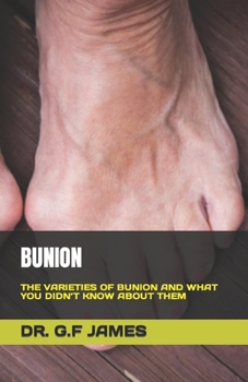 Paperback Bunion: The Varieties of Bunion and What You Didn't Know about Them Book