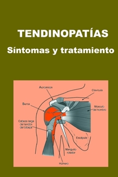Paperback Tendinopatías: Síntomas y tratamiento [Spanish] Book