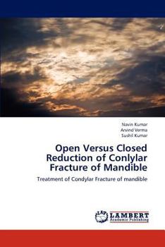 Paperback Open Versus Closed Reduction of Conlylar Fracture of Mandible Book