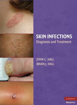 Hardcover Skin Infections: Diagnosis and Treatment Book