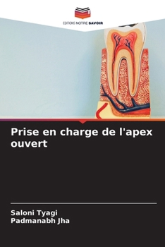 Paperback Prise en charge de l'apex ouvert [French] Book