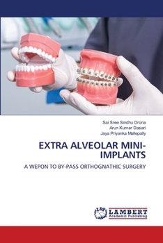 Paperback Extra Alveolar Mini-Implants Book