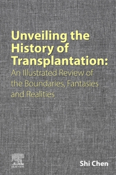 Hardcover Unveiling the History of Transplantation: An Illustrated Review of the Boundaries, Fantasies and Realities Book