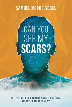 Hardcover Can You See My Scars? Book