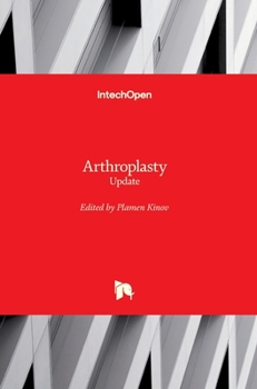 Hardcover Arthroplasty: Update Book