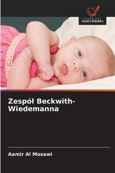 Zespól Beckwith-Wiedemanna (Polish Edition)