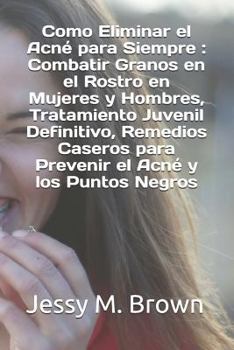 Paperback Como Eliminar el Acné para Siempre: Combatir Granos en el Rostro en Mujeres y Hombres, Tratamiento Juvenil Definitivo, Remedios Caseros para Prevenir [Spanish] Book