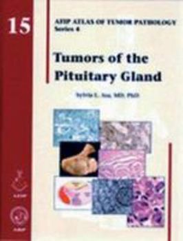 Hardcover Tumors of the Pituitary Gland Book