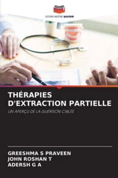 Paperback Thérapies d'Extraction Partielle [French] Book
