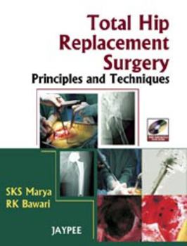 Hardcover Total Hip Replacement Surgery: Principles and Techniques Book