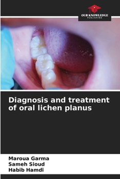Paperback Diagnosis and treatment of oral lichen planus Book