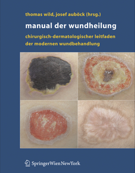 Hardcover Manual Der Wundheilung: Chirurgisch-Dermatologischer Leitfaden Der Modernen Wundbehandlung [German] Book