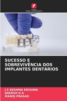 Sucesso E Sobrevivência DOS Implantes Dentários (Portuguese Edition)