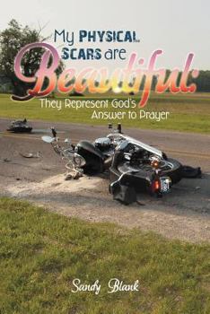 Paperback My Physical Scars Are Beautiful: They Represent God's Answer to Prayer Book