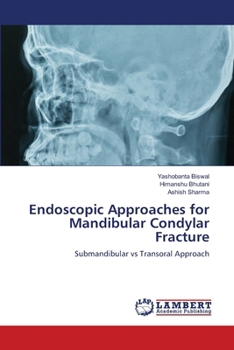 Paperback Endoscopic Approaches for Mandibular Condylar Fracture Book