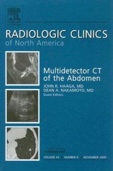 Hardcover Mdct of the Abdomen, an Issue of Radiologic Clinics: Volume 43-6 Book