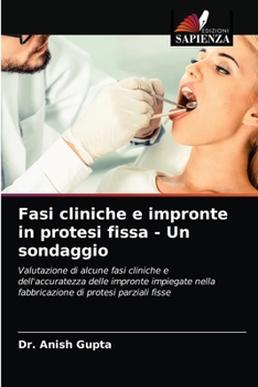Paperback Fasi cliniche e impronte in protesi fissa - Un sondaggio [Italian] Book