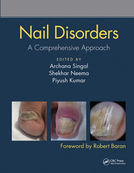 Paperback Nail Disorders: A Comprehensive Approach Book